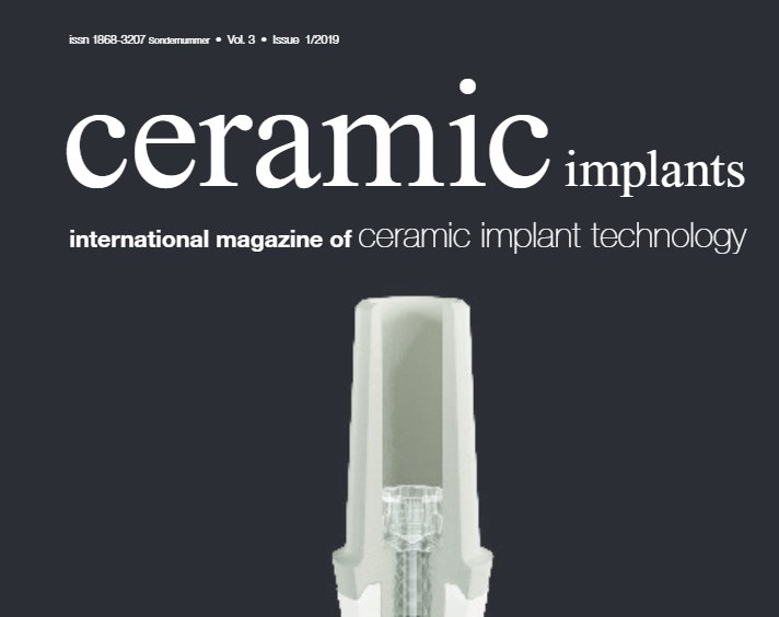 Ceramic Imlants - International Magazine