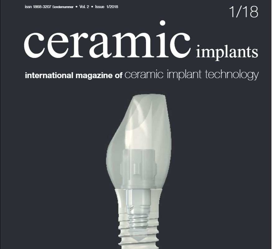 CERAMIC IMPLANTS – INTERNATIONAL MAGAZINE OF CERAMIC IMPLANT TECHNOLOGY – VOL 2